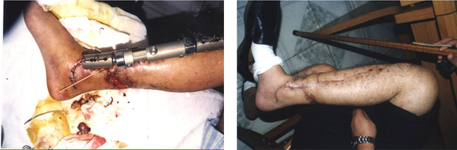 首页-人生就是博中国官方网站